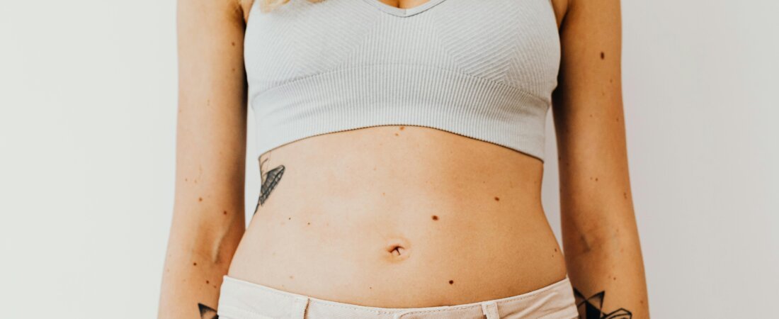 Como acabar com o estufamento abdominal: Dicas de alimentação e postura